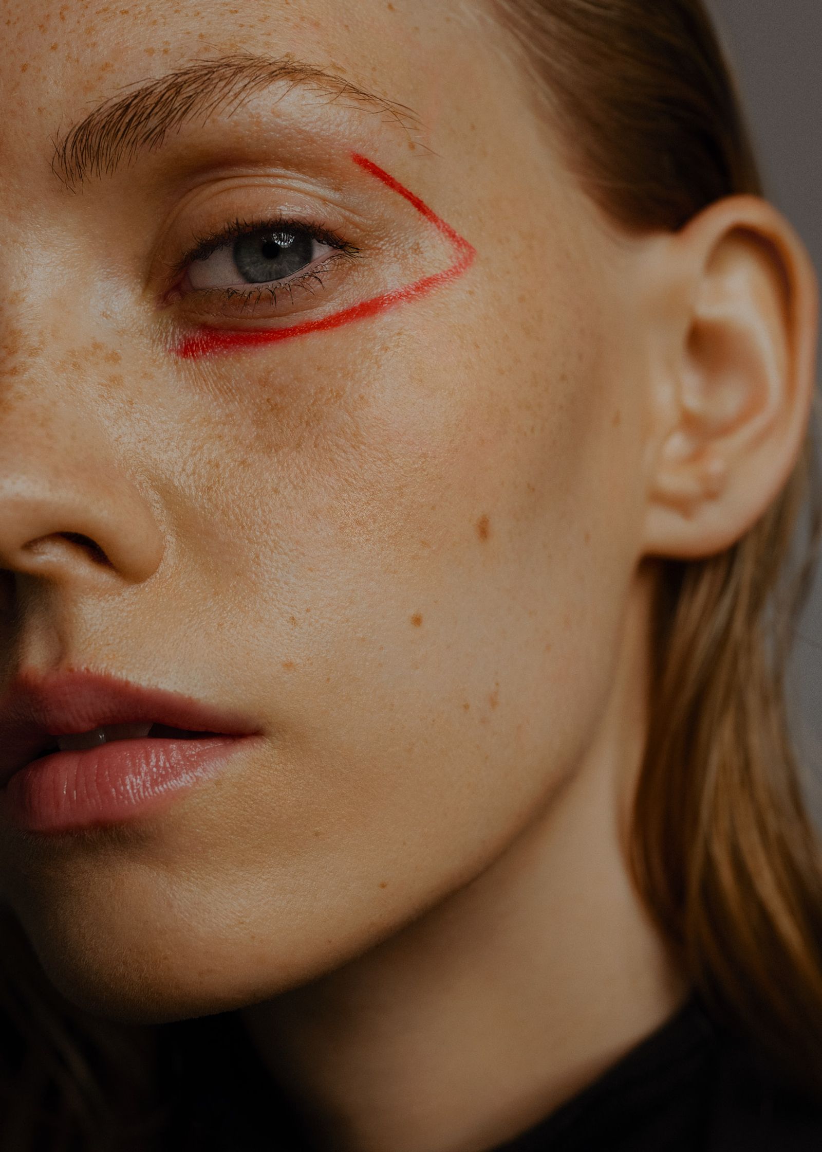 a woman with freckles and red lines on her face