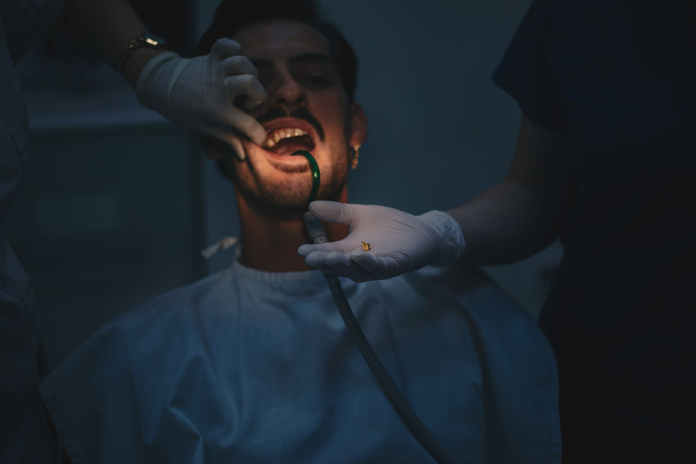 A patient in a dental chair with an assistant holding a removed tooth in a gloved hand while another assistant works on the patient's mouth.