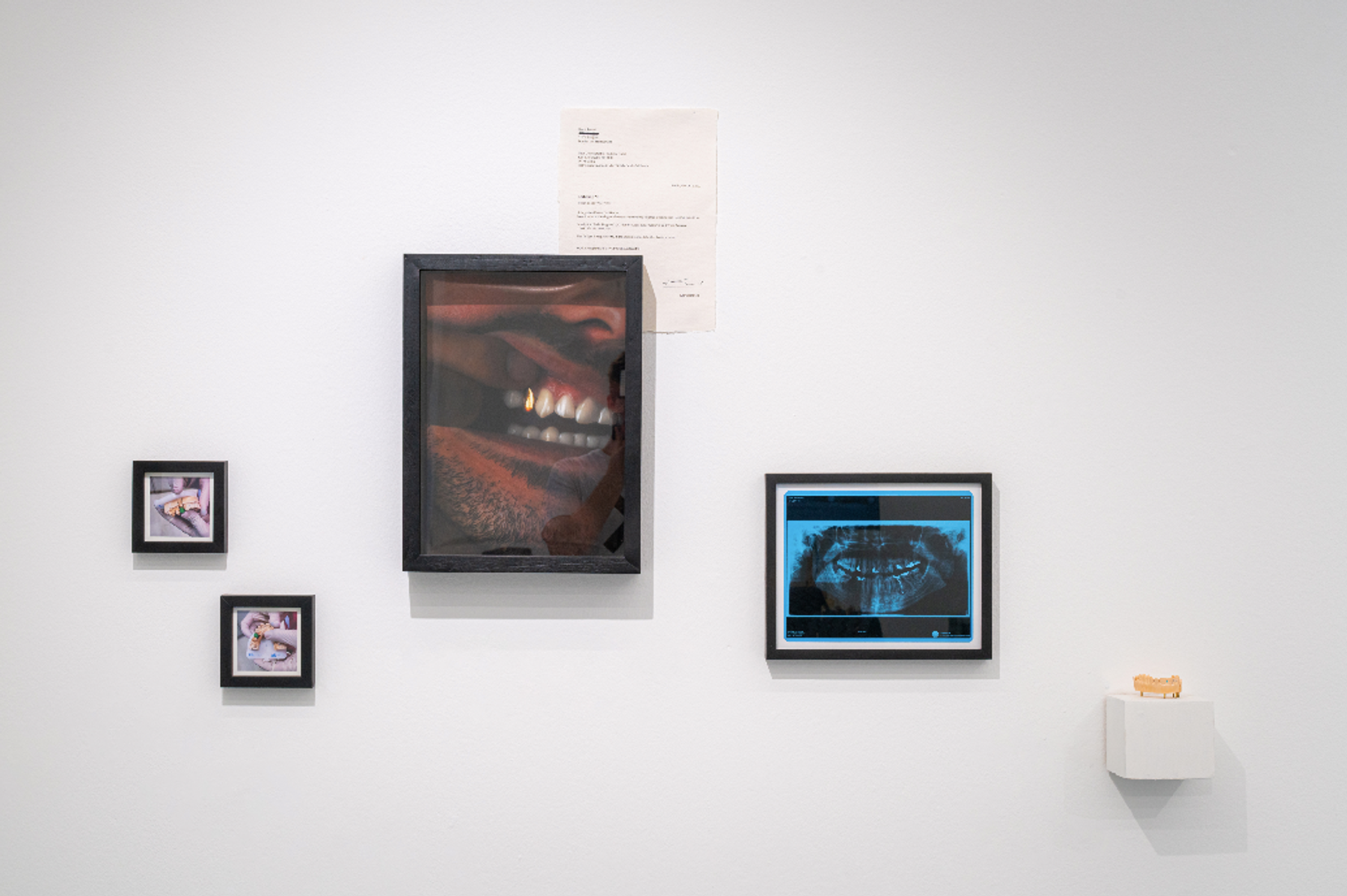 An art installation on a white wall features framed photos of a person's mouth and gold teeth, a dental X-ray, smaller framed photos, and a dental mold on a pedestal, with a printed document taped above.