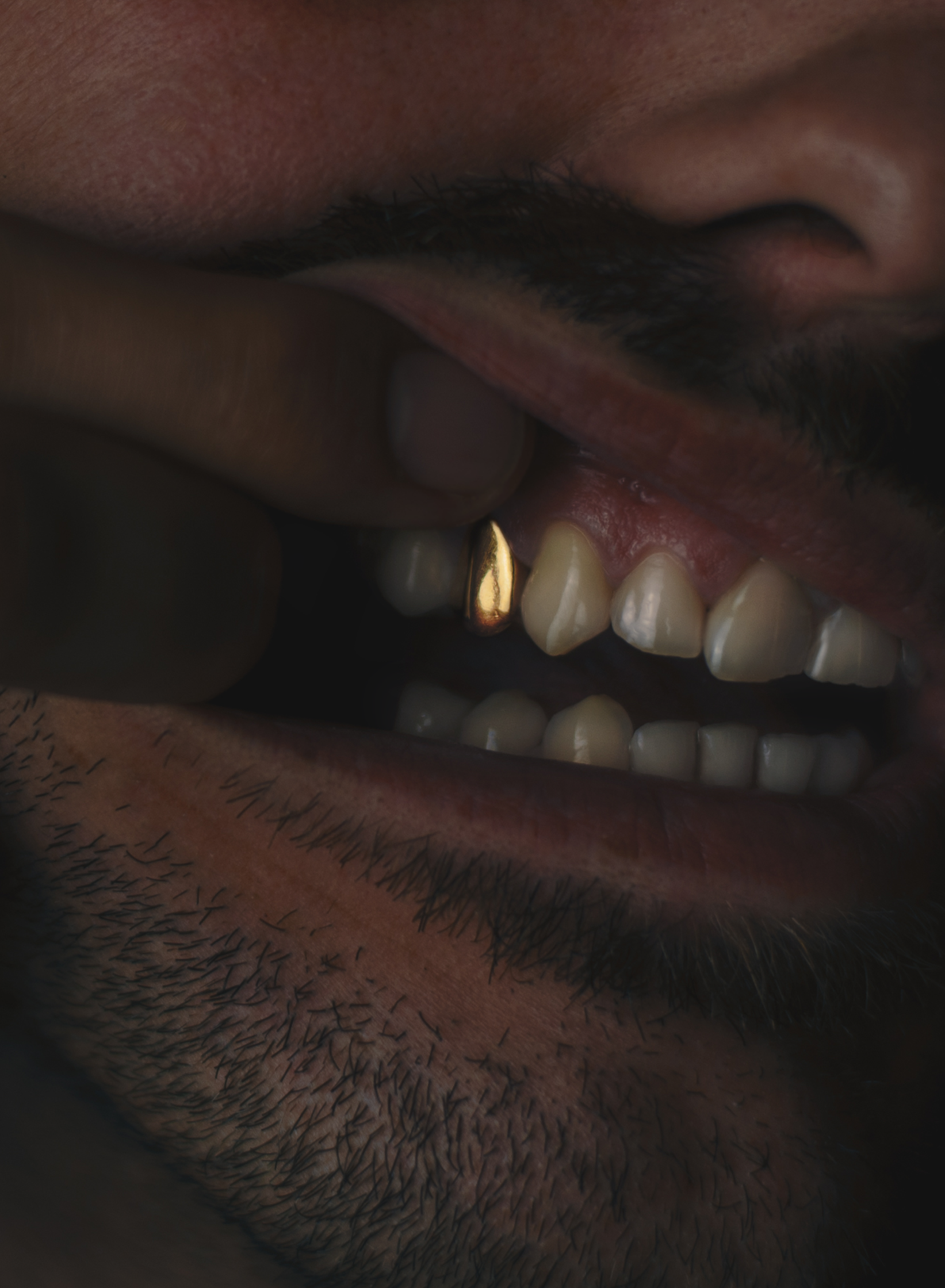 A close-up of a person revealing a gold tooth with their finger.